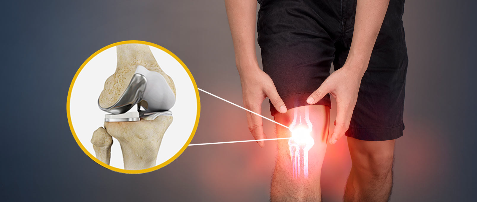 partial-robotic-knee-replacement